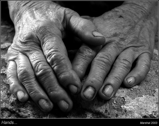  Hands