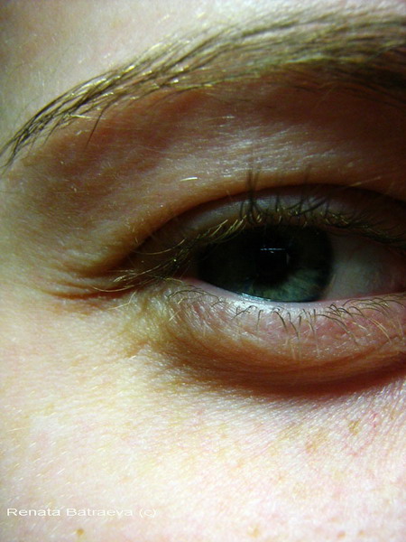  eye