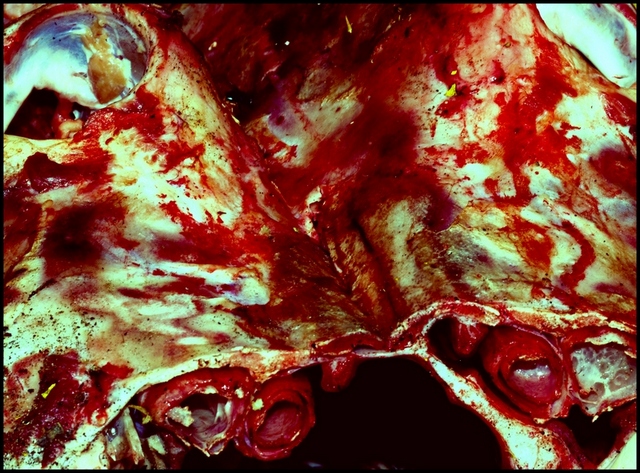  meat