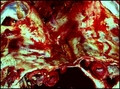 meat