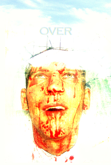    - 